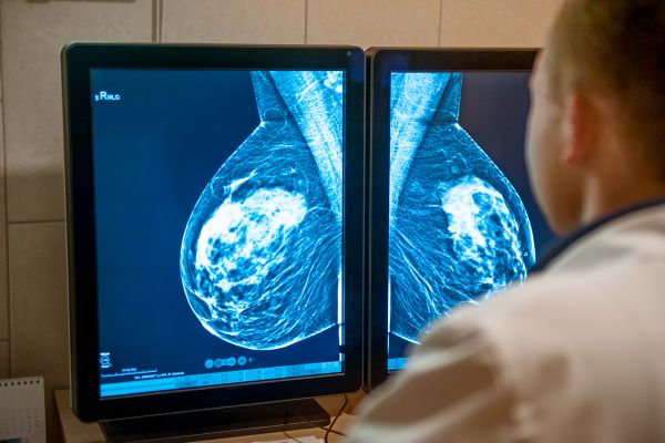 Woman receiving a mammogram at urgent care, X-ray, imaging, testing