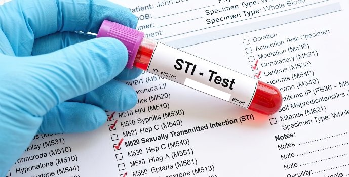 Gloved-hand-holding-STI-test-vial
