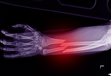 X-ray technician performing an X-ray on a patient at Core Medicine